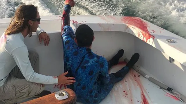 Imagem ilustrativa da notícia Mergulhador fica gravemente ferido após ser atacado por tubarão e as imagens viralizaram 