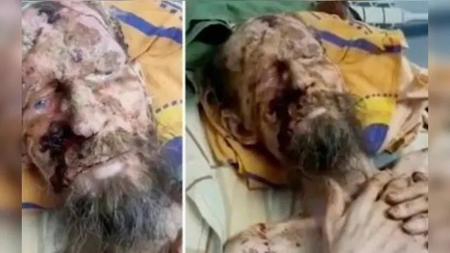 Imagem ilustrativa da notícia Russo é 'mumificado vivo' após ser mantido refém de urso