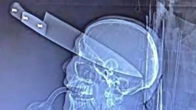 Imagem ilustrativa da notícia Homem morre após levar facada na cabeça em briga com o cunhado