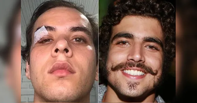Imagem ilustrativa da notícia Justiça condena Caio Castro por agressão a fotógrafo
