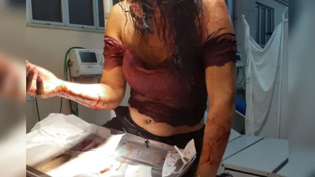 Imagem ilustrativa da notícia Mulher tem rosto desfigurado após ser agredida em casa de show em Belém
