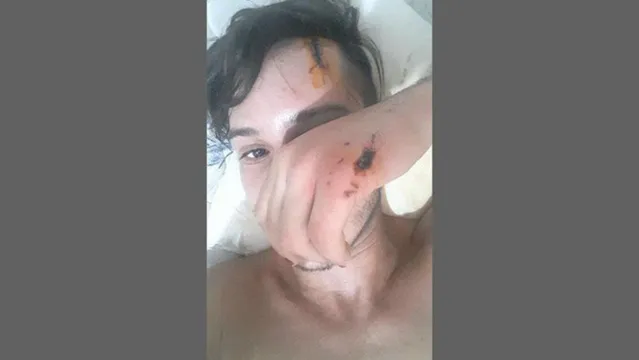 Imagem ilustrativa da notícia 'Sobrevivi', diz jovem gay que foi espancado e estuprado em Parada Gay