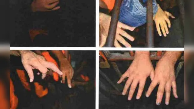 Imagem ilustrativa da notícia Força-tarefa é acusada de quebrar dedos dos presos