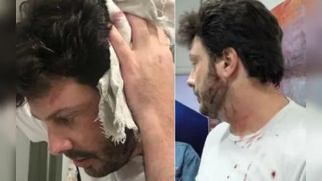 Imagem ilustrativa da notícia Danilo Gentilli é surpreendido com garrafada na cabeça durante gravação de programa