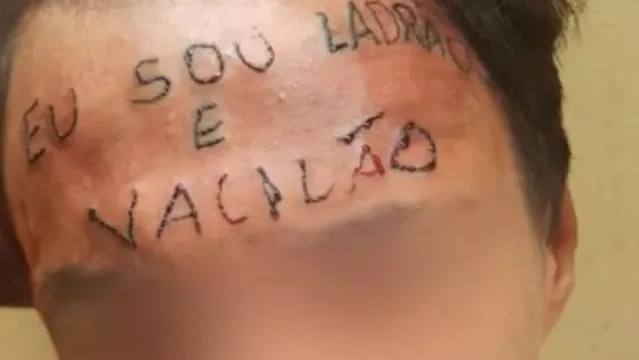Imagem ilustrativa da notícia Jovem que teve a testa tatuada com 'ladrão e vacilão' é condenado a 4 anos de prisão