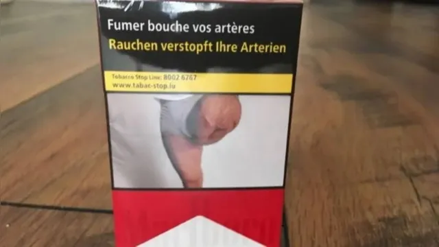 Imagem ilustrativa da notícia Homem descobre foto da perna amputada em maço de cigarro. Veja!