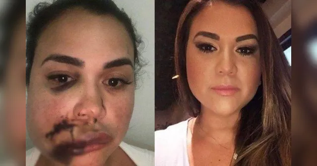 Imagem ilustrativa da notícia Mulher é agredida em restaurante durante festa de aniversário: 'um copo no meu rosto'