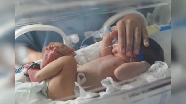 Imagem ilustrativa da notícia Hospital alerta para cuidados com mães de prematuros