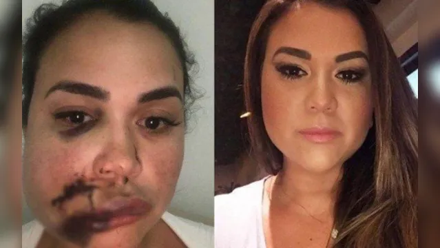 Imagem ilustrativa da notícia Mulher é agredida em restaurante durante festa de aniversário: 'um copo no meu rosto'
