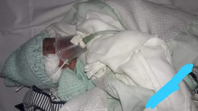 Imagem ilustrativa da notícia Morre bebê prematuro que respirava com copo plástico improvisado em hospital do Marajó