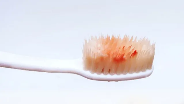 Imagem ilustrativa da notícia Criança de 5 anos tem garganta furada após cair com escova de dente na boca
