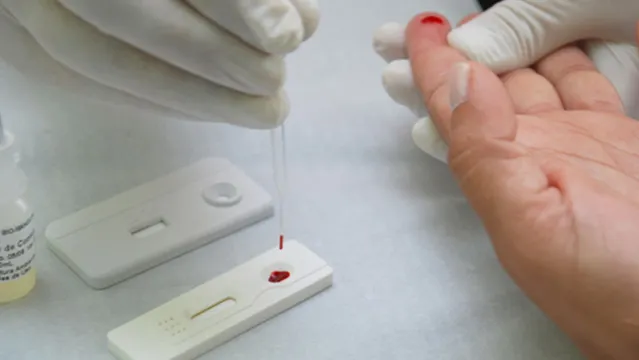 Imagem ilustrativa da notícia Unidades Básicas de Saúde de Belém oferecem testes gratuitos para HIV
