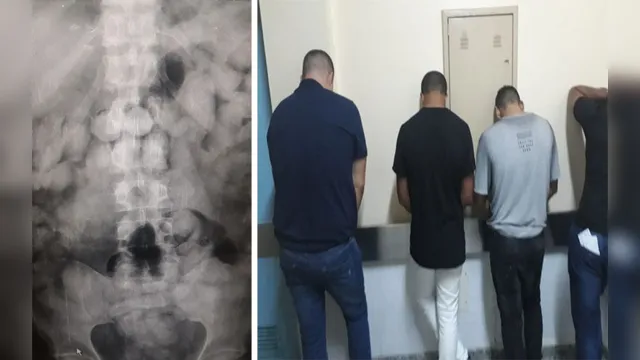 Imagem ilustrativa da notícia Raio-X comprova drogas no estômago de presos
no aeroporto de Belém