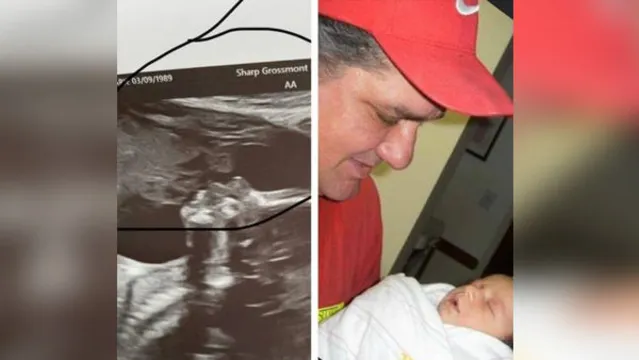 Imagem ilustrativa da notícia Grávida vê o pai já falecido em exame de ultrassom igual em foto de 10 anos atrás