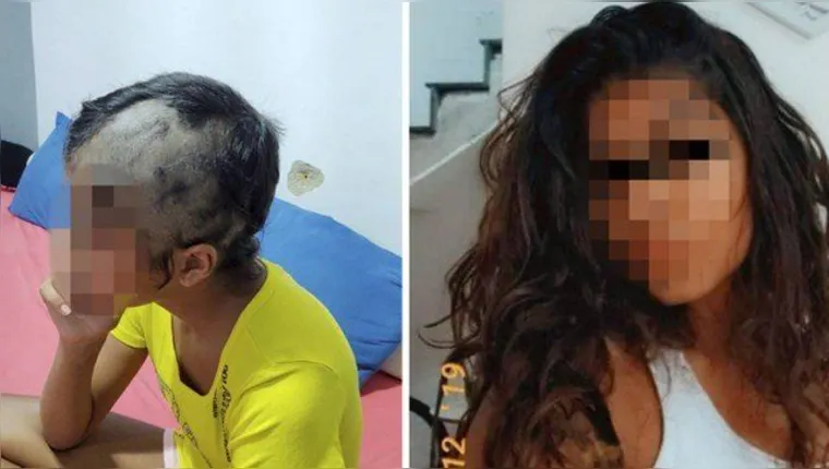 Imagem ilustrativa da notícia Bombeiro é acusado de raspar o cabelo da própria filha por ciúmes