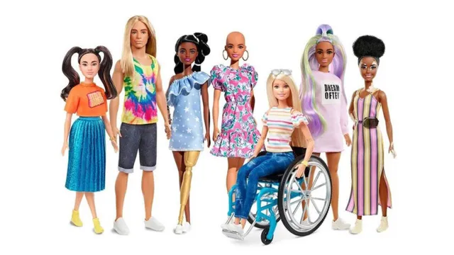 Imagem ilustrativa da notícia Barbie terá bonecas carecas e com vitiligo para dar mais representatividade à coleção