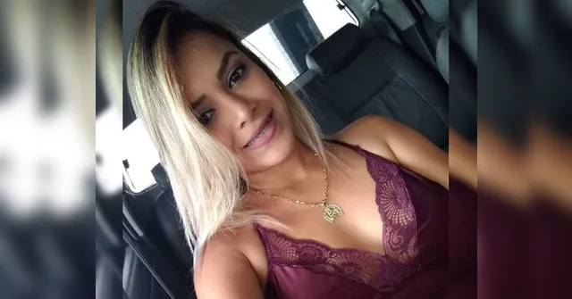Imagem ilustrativa da notícia Jovem baleada no rosto pelo ex "ressuscita" após morte cerebral atestada