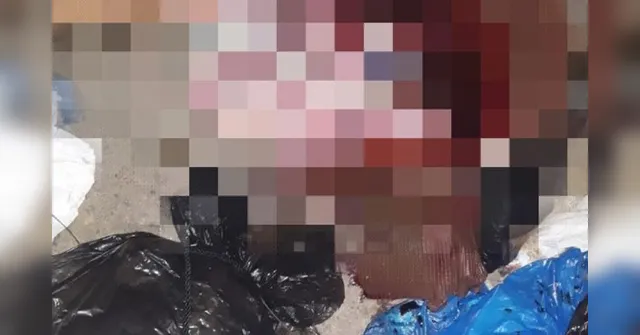 Imagem ilustrativa da notícia Recém-nascida é achada chorando dentro de caixa de sapato em lixeira