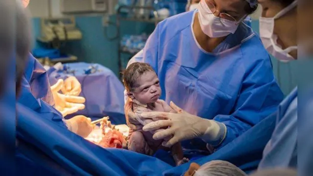 Imagem ilustrativa da notícia Bebê nasce com cara de 'brava' e imagem viraliza na internet 