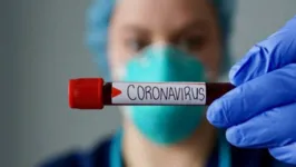 Imagem ilustrativa da notícia Coronavírus: sobe para 14 número de casos no Brasil