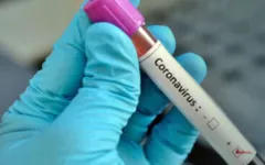 Imagem ilustrativa da notícia Brasil pode usar aparelhos veterinários para tratar humanos afetados pelo coronavírus