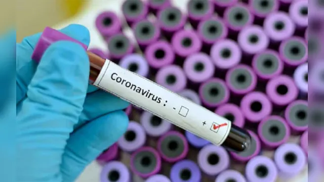 Imagem ilustrativa da notícia Casos de coronavírus já chegam a 100 no Brasil e nenhum no Pará