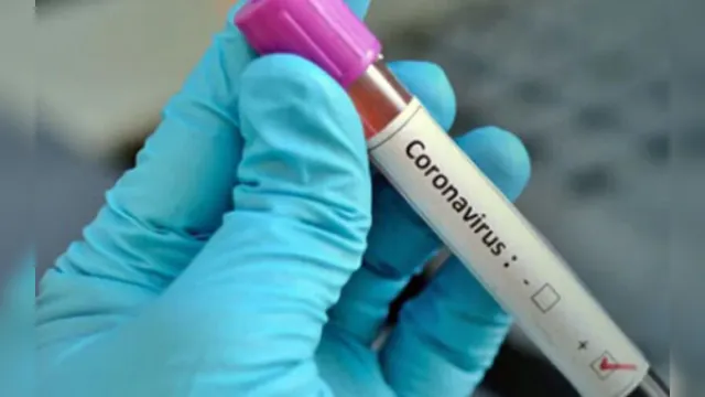 Imagem ilustrativa da notícia Europa chega a 160 mil casos de coronavírus, o dobro da China