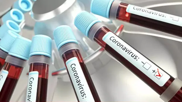 Imagem ilustrativa da notícia Tipo sanguíneo "A" é mais suscetível ao coronavírus, diz New York Post