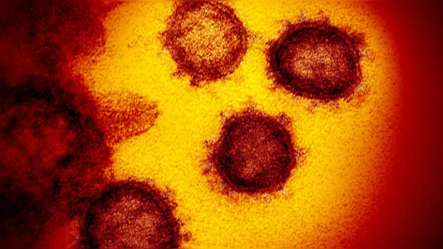 Imagem ilustrativa da notícia Exame
para coronavírus em paciente de Belém dá negativo