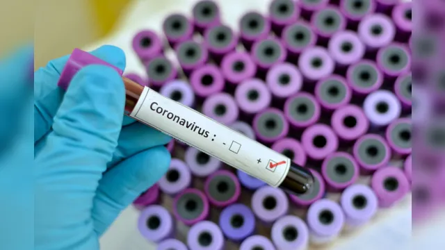 Imagem ilustrativa da notícia Coronavírus:
aumenta para 12 o número de casos em análise no Pará