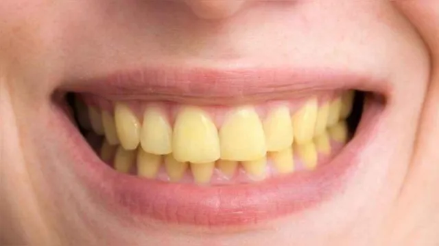 Imagem ilustrativa da notícia Comidas e bebidas podem causar sorriso amarelo? Veja mitos e verdades