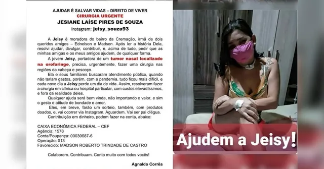 Imagem ilustrativa da notícia Jovem com tumor pede ajuda nas redes sociais para conseguir cirurgia