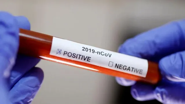 Imagem ilustrativa da notícia Paciente agride médico a socos após testar positivo para coronavírus