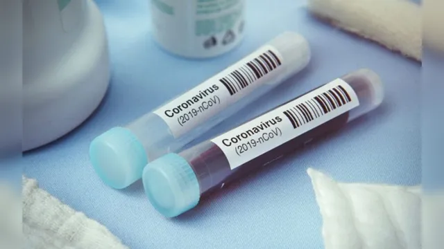 Imagem ilustrativa da notícia Brasil recebe 500 mil kits de teste rápido do coronavírus