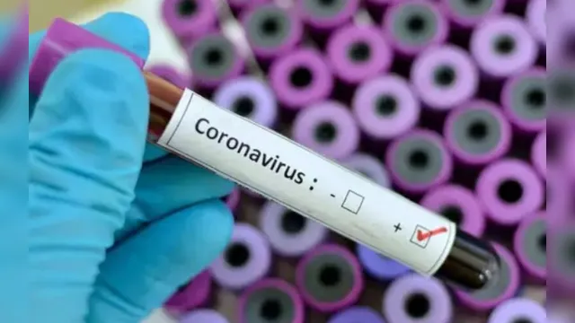 Imagem ilustrativa da notícia Estados Unidos registram 1.738 mortes por coronavírus nas últimas 24 horas