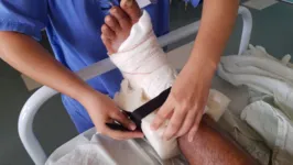Órteses são produzidas por terapeutas do Labta