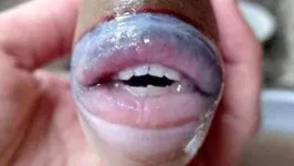Imagem ilustrativa da notícia Criatura bizarra com boca e dentes "humanos" intriga a web