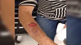 Imagem ilustrativa da notícia Idosa tem braço esmagado por portão de supermercado 