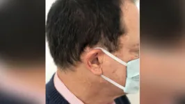 Imagem ilustrativa da notícia Máscaras faciais podem causar "orelhas de abano"?