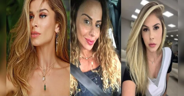 Imagem ilustrativa da notícia Famosas se rendem a técnica que deixa lábios com aspecto "saudável"
