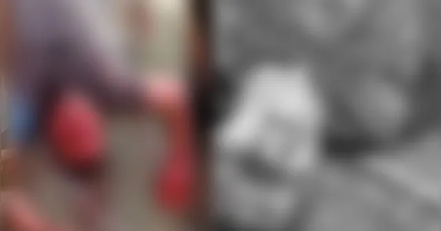 Imagem ilustrativa da notícia Briga entre “amigos” termina com faca atravessada no pescoço e olhos perfurados