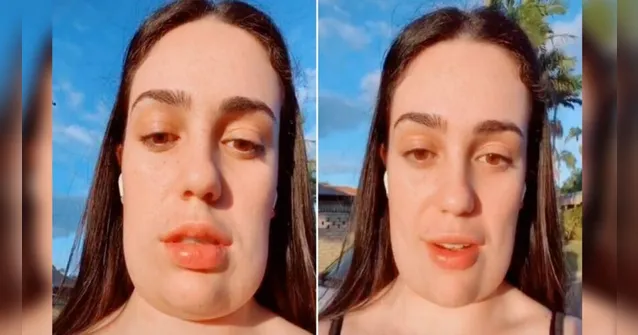Imagem ilustrativa da notícia Mulher fica com 'cabeça quadrada' após procedimento estético