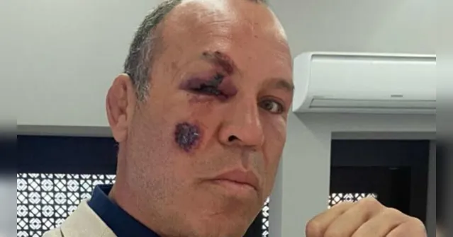 Imagem ilustrativa da notícia "Poderia ter morrido", diz Wanderley Silva após ser atropelado em bicicleta