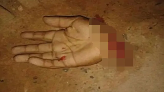 Imagem ilustrativa da notícia Homem decepa mão da esposa e do próprio irmão a golpes de facão