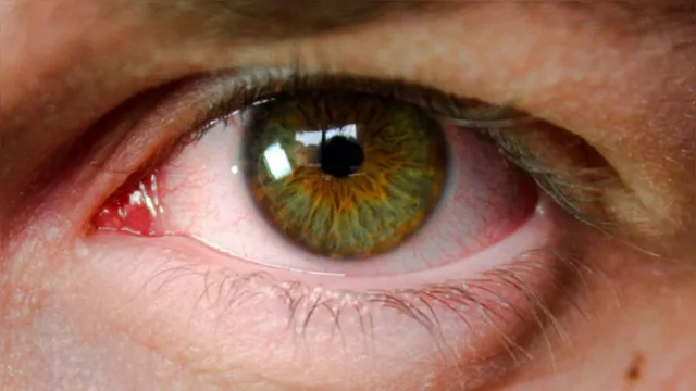 Imagem ilustrativa da notícia Cerca de 40% das pessoas desconhecem o glaucoma