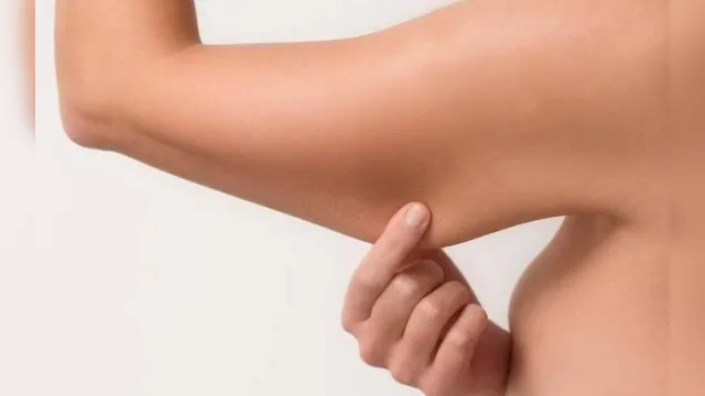 Imagem ilustrativa da notícia Acúmulo de gordura nas pernas e braços pode ser sinal de doença vascular 