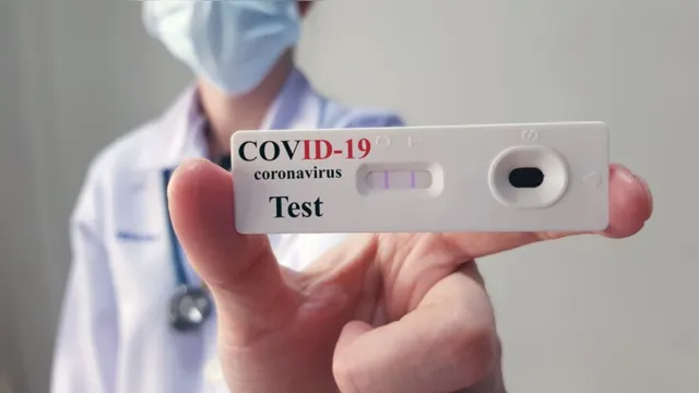 Imagem ilustrativa da notícia Planos de saúde estão obrigados a cobrir teste para Covid-19