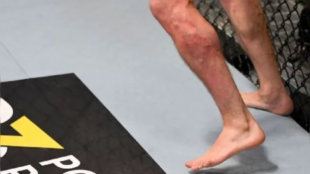 Imagem ilustrativa da notícia Lutador é massacrado e acaba nocauteado em confronto do UFC; veja o vídeo!