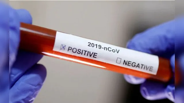 Imagem ilustrativa da notícia Vacina para covid-19 cria anticorpos em 100% dos testados