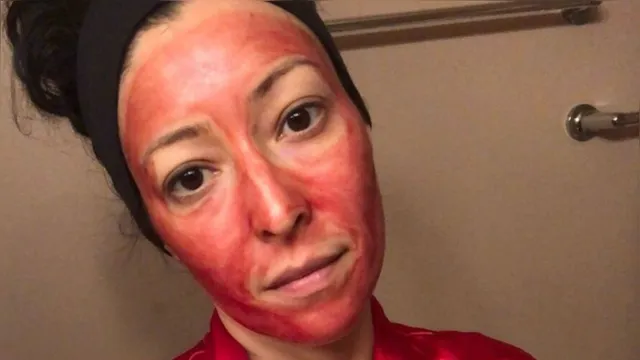 Imagem ilustrativa da notícia Mulher usa sangue menstrual para tratamento facial: pele "macia" e "brilhante"